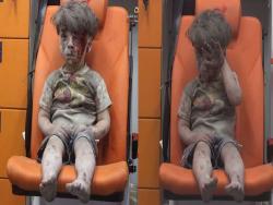 從炸毀家園中被救出的男孩在遭遇空襲後的驚嚇無語影像，惹人揪心…就連國外主播都哭了！
