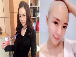 《甘味人生》中的美女臥底警察「李沁凝」罹卵巢癌，經歷9次化療，剃光頭髮樂觀抗癌！