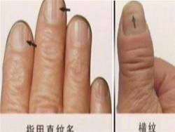 手指告訴你壽命有多長！原來常出手汗的人竟然會…太驚人了！