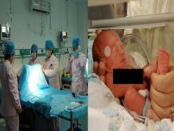 為了要孩子她「流產7次」才懷上，醫生看到嬰兒都大吃一驚！